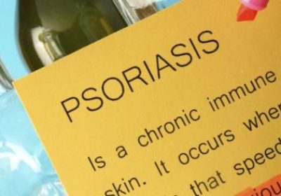Psoriasis