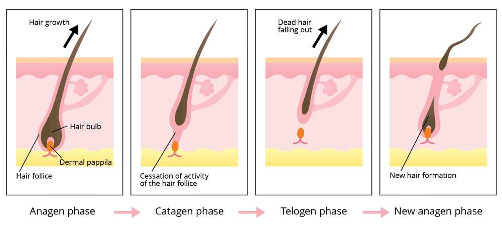 Laser Hair Removal