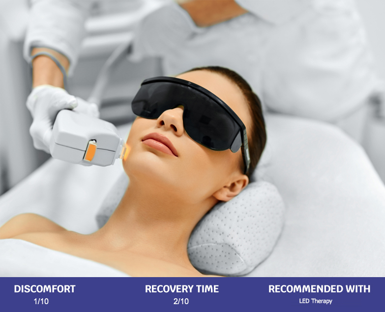 IPL Photo Rejuvenation