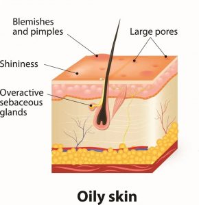 Congested & Oily Skin Treatment