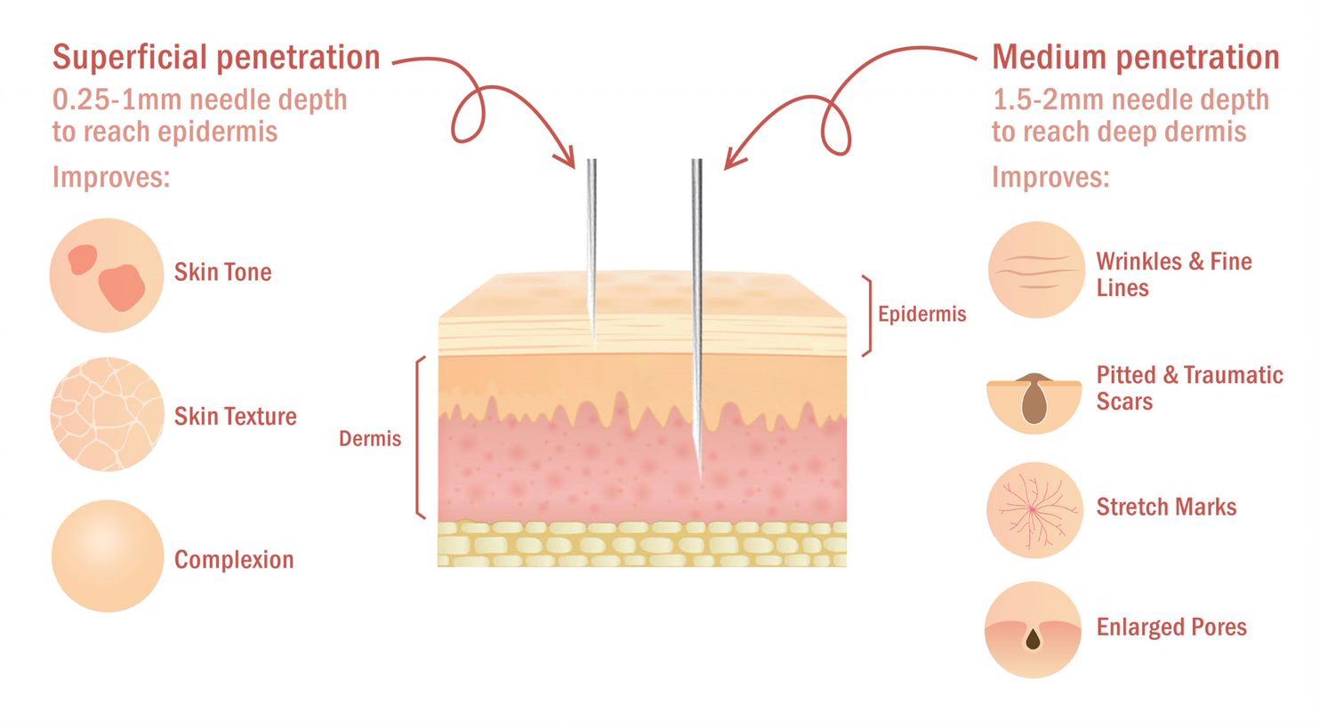 Skin Needling in Melbourne