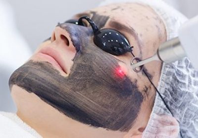 6 Benefits Of Carbon Laser Treatment