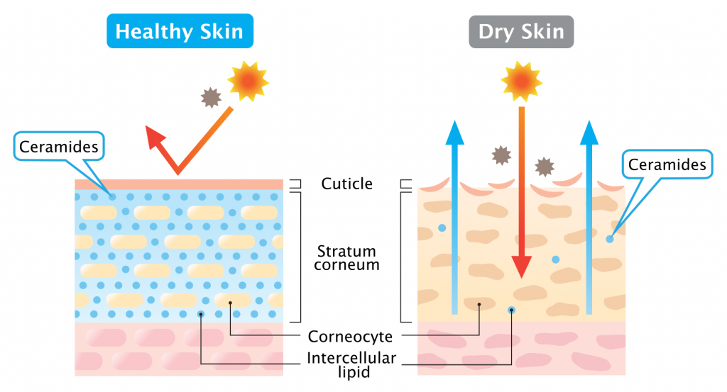 Skin: Dry, Dull, Lacklustre