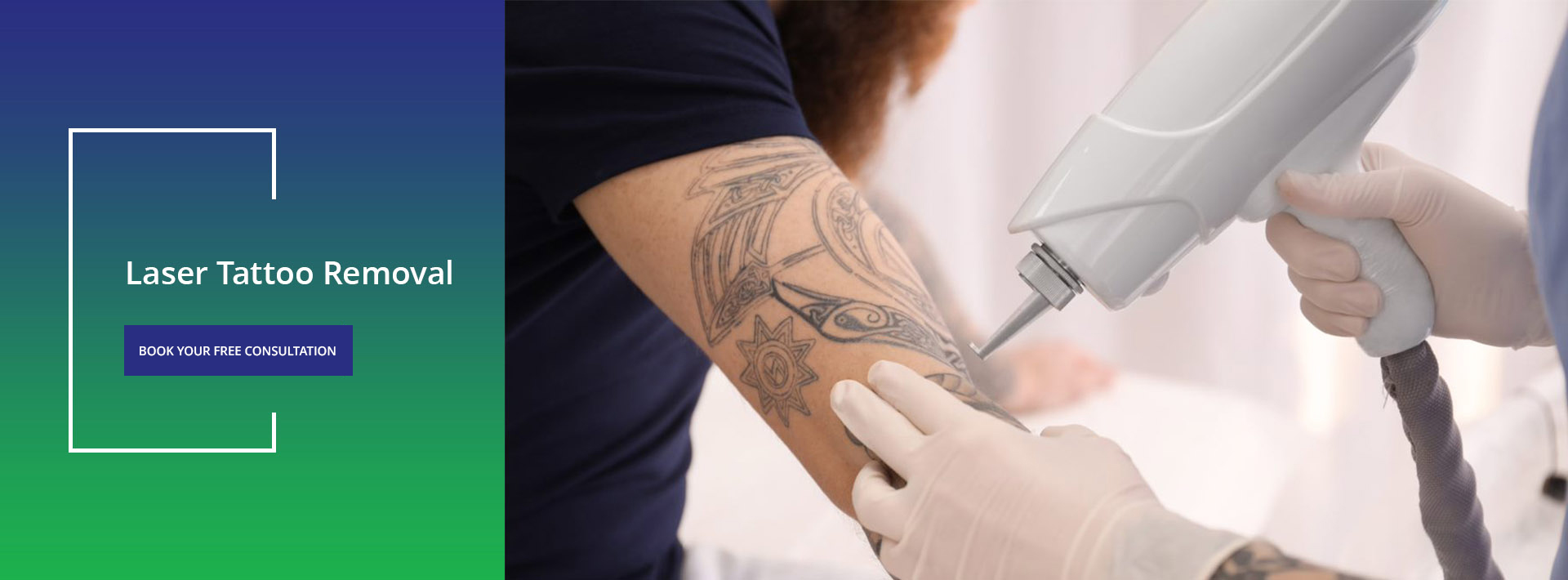 Laser Tattoo Removal  Brisbane Skin Dermatology